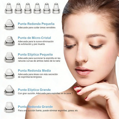 Removedor de Puntos Negros Recargable – Limpieza Facial Profunda con 5 Cabezales