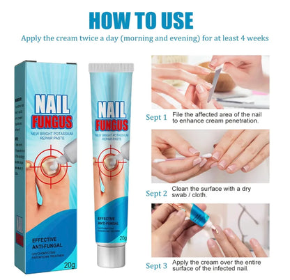 Crema para Hongos en Uñas y Pies