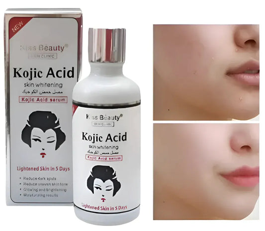 Sérum Ácido Kójico Aclarante Facial – Reduce Manchas, Melasma y Tono Desigual