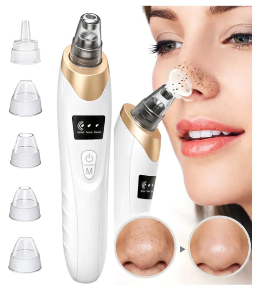 Removedor de Puntos Negros Recargable – Limpieza Facial Profunda con 5 Cabezales