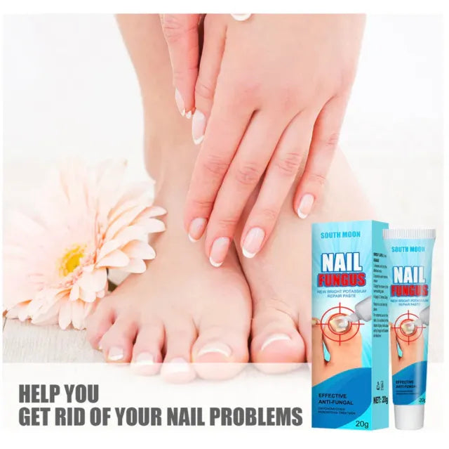 Crema para Hongos en Uñas y Pies