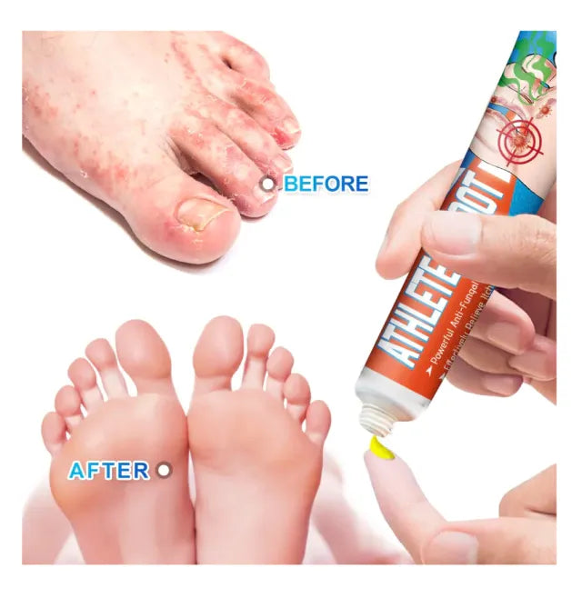 Crema para Eliminar Mal Olor y Picazón