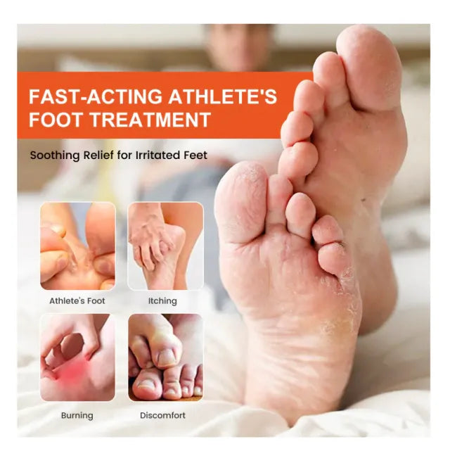 Crema para Eliminar Mal Olor y Picazón